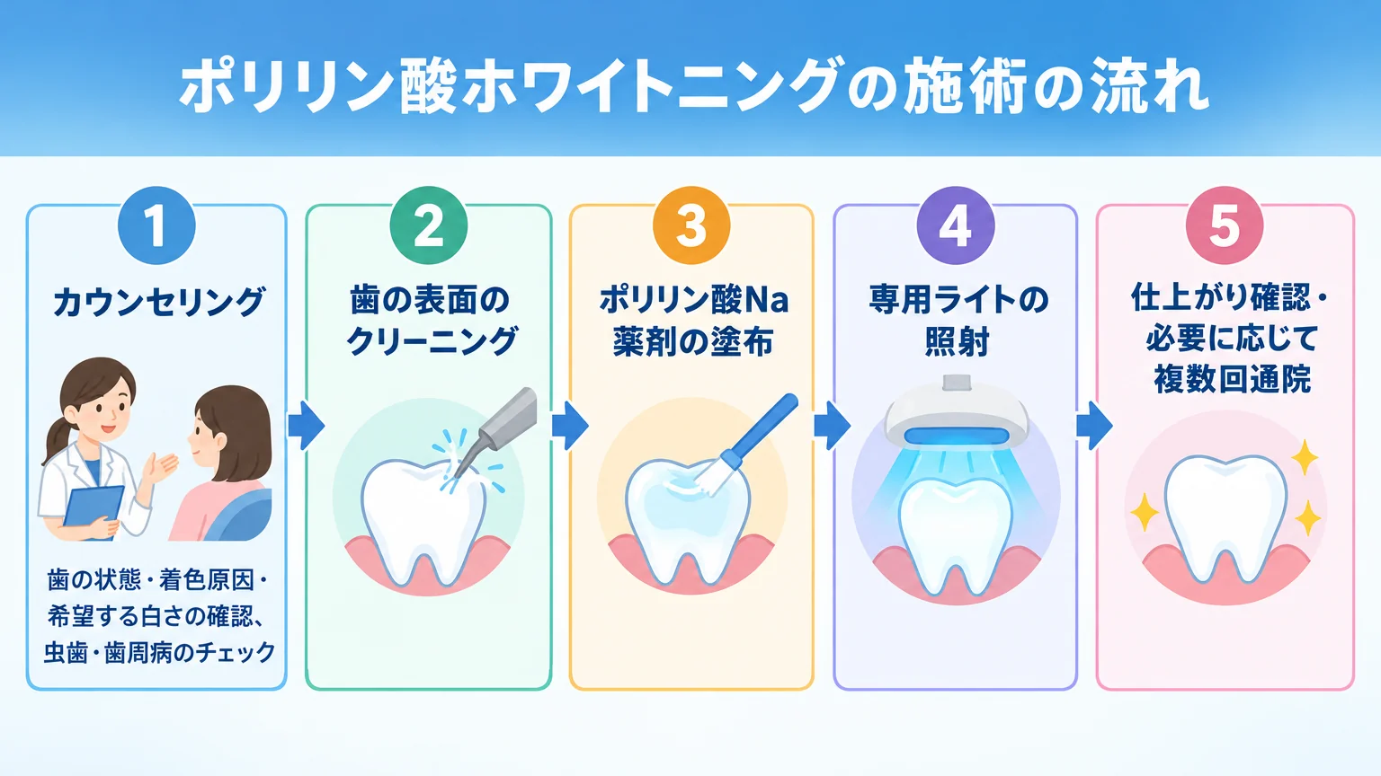 ポリリン酸ホワイトニングの施術の流れを示すフロー図。ステップ1『カウンセリング(歯の状態・着色原因・希望する白さの確認、虫歯・歯周病のチェック)』→ステップ2『歯の表面のクリーニング』→ステップ3『ポリリン酸Na薬剤の塗布』→ステップ4『専用ライトの照射』→ステップ5『仕上がり確認・必要に応じて複数回通院』の5段階を矢印でつなぐ