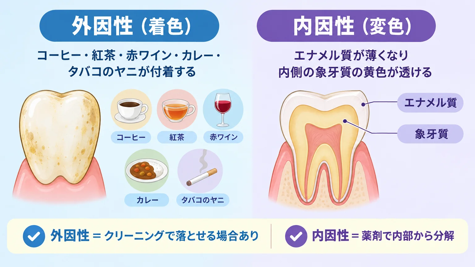 歯の黄ばみの2タイプを対比するイラスト。左に『外因性(着色)』として歯の表面にコーヒー・紅茶・赤ワイン・カレー・タバコのヤニが付着する図、右に『内因性(変色)』としてエナメル質が薄くなり内側の象牙質の黄色が透ける断面図。下部に『外因性=クリーニングで落とせる場合あり/内因性=薬剤で内部から分解』の注記