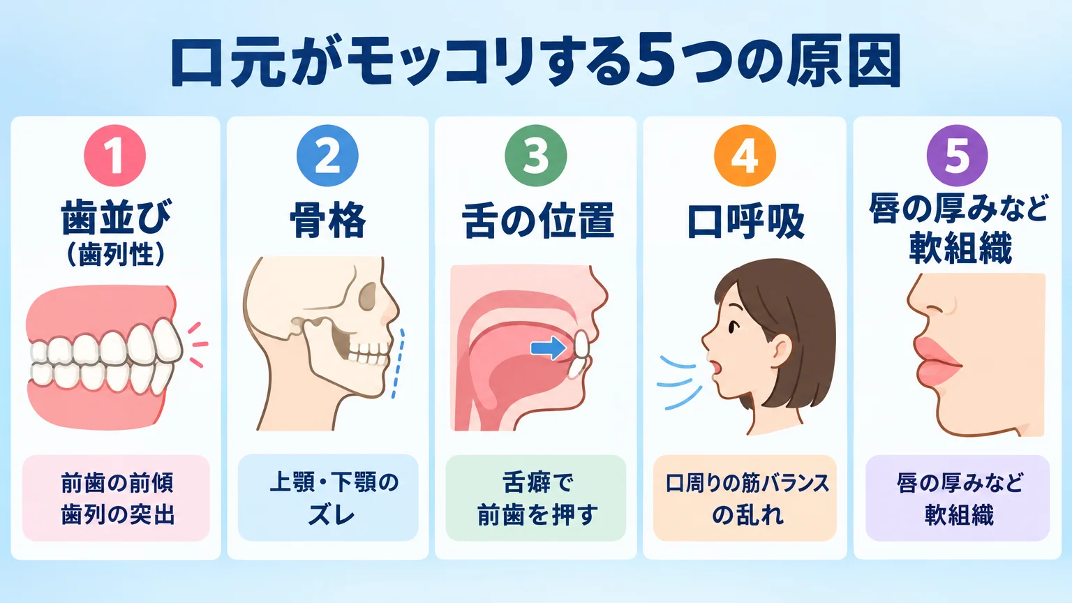 口元がモッコリする5つの原因を並べたインフォグラフィック。①歯並び（歯列性）＝前歯の前傾・歯列の突出、②骨格＝上顎・下顎のズレ、③舌の位置＝舌癖で前歯を押す、④口呼吸＝口周りの筋バランスの乱れ、⑤唇の厚みなど軟組織。各原因にアイコンと一言説明を添える