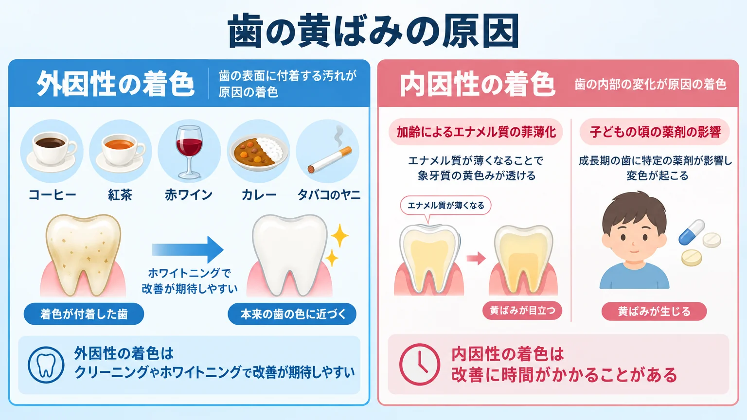 歯の黄ばみの原因を外因性と内因性に分けて解説するイラスト。外因性の着色（コーヒー・紅茶・赤ワイン・カレー・タバコのヤニが歯の表面に付着/ホワイトニングで改善が期待しやすい）、内因性の着色（加齢によるエナメル質の菲薄化で象牙質の黄色みが透ける・子どもの頃の薬剤の影響/改善に時間がかかることがある）を2タイプで対比した概念図