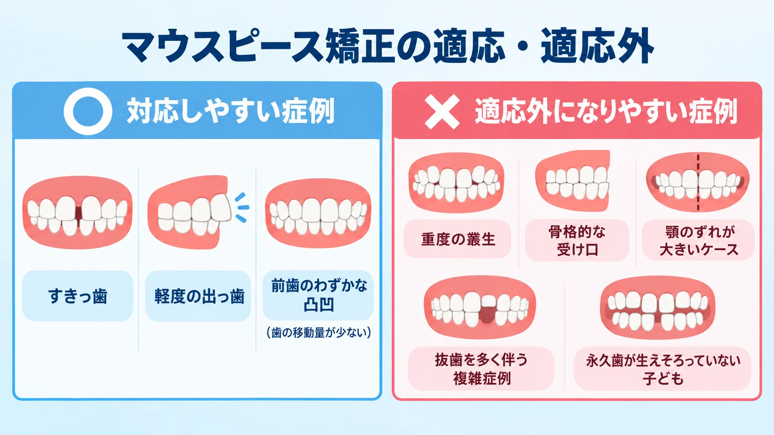 マウスピース矯正の適応・適応外を分けたイラスト。対応しやすい症例=すきっ歯・軽度の出っ歯・前歯のわずかな凸凹(歯の移動量が少ない)。適応外になりやすい症例=重度の叢生・骨格的な受け口・顎のずれが大きいケース・抜歯を多く伴う複雑症例・永久歯が生えそろっていない子ども。〇と×で振り分けた概念図