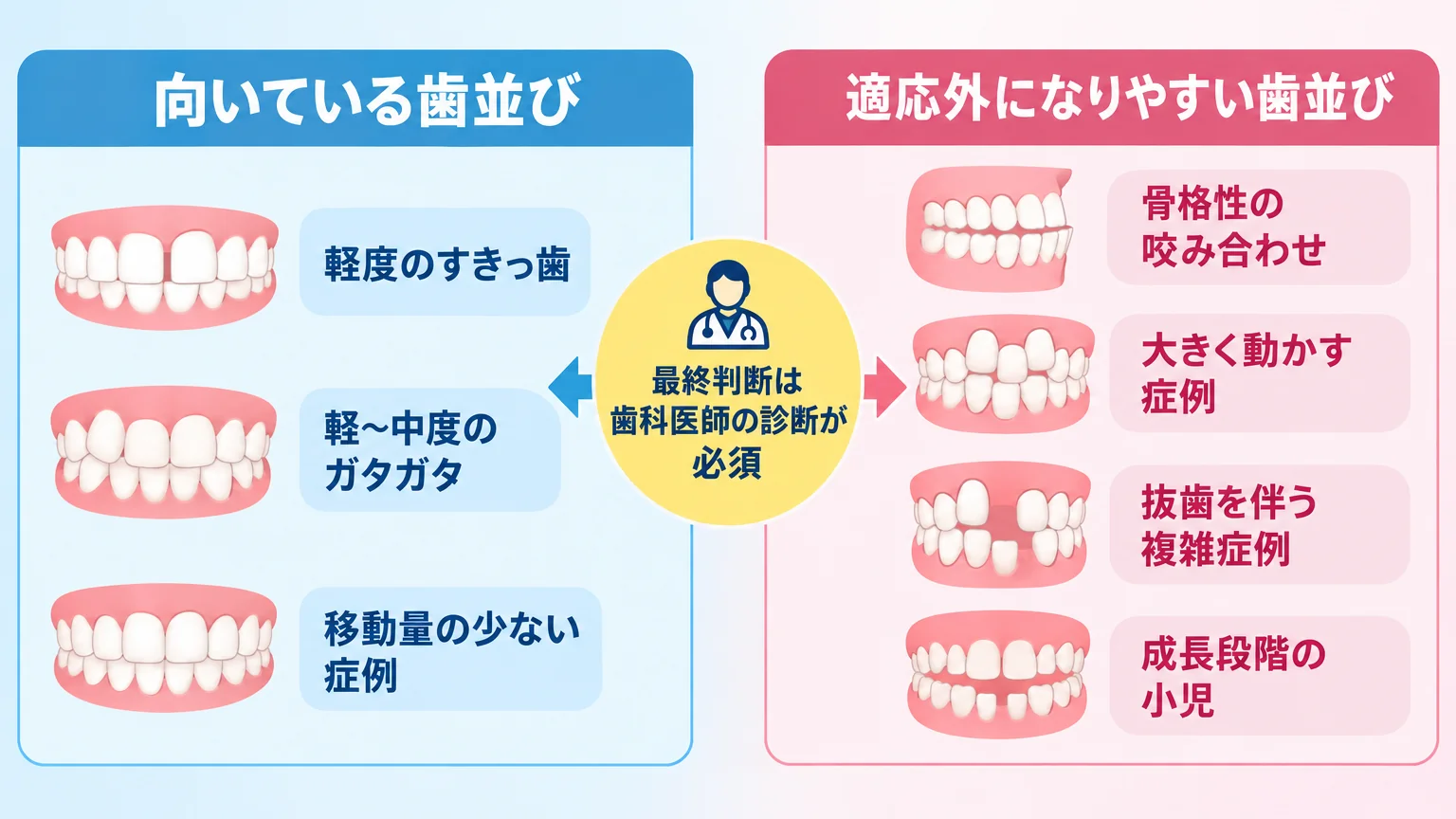 マウスピース矯正の適応・適応外を整理したイラスト図。左『向いている歯並び(軽度のすきっ歯・軽〜中度のガタガタ・移動量の少ない症例)』、右『適応外になりやすい歯並び(骨格性の咬み合わせ・大きく動かす症例・抜歯を伴う複雑症例・成長段階の小児)』を歯のアイコンで対比。中央に『最終判断は歯科医師の診断が必須』の注記