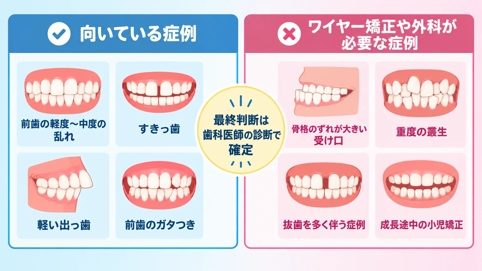 マウスピース矯正の適応範囲を示すイラスト図。左側『向いている症例(前歯の軽度〜中度の乱れ・すきっ歯・軽い出っ歯・前歯のガタつき)』、右側『ワイヤー矯正や外科が必要な症例(骨格のずれが大きい受け口・重度の叢生・抜歯を多く伴う症例・成長途中の小児矯正)』の2分割レイアウト。中央に『最終判断は歯科医師の診断で確定』の注記