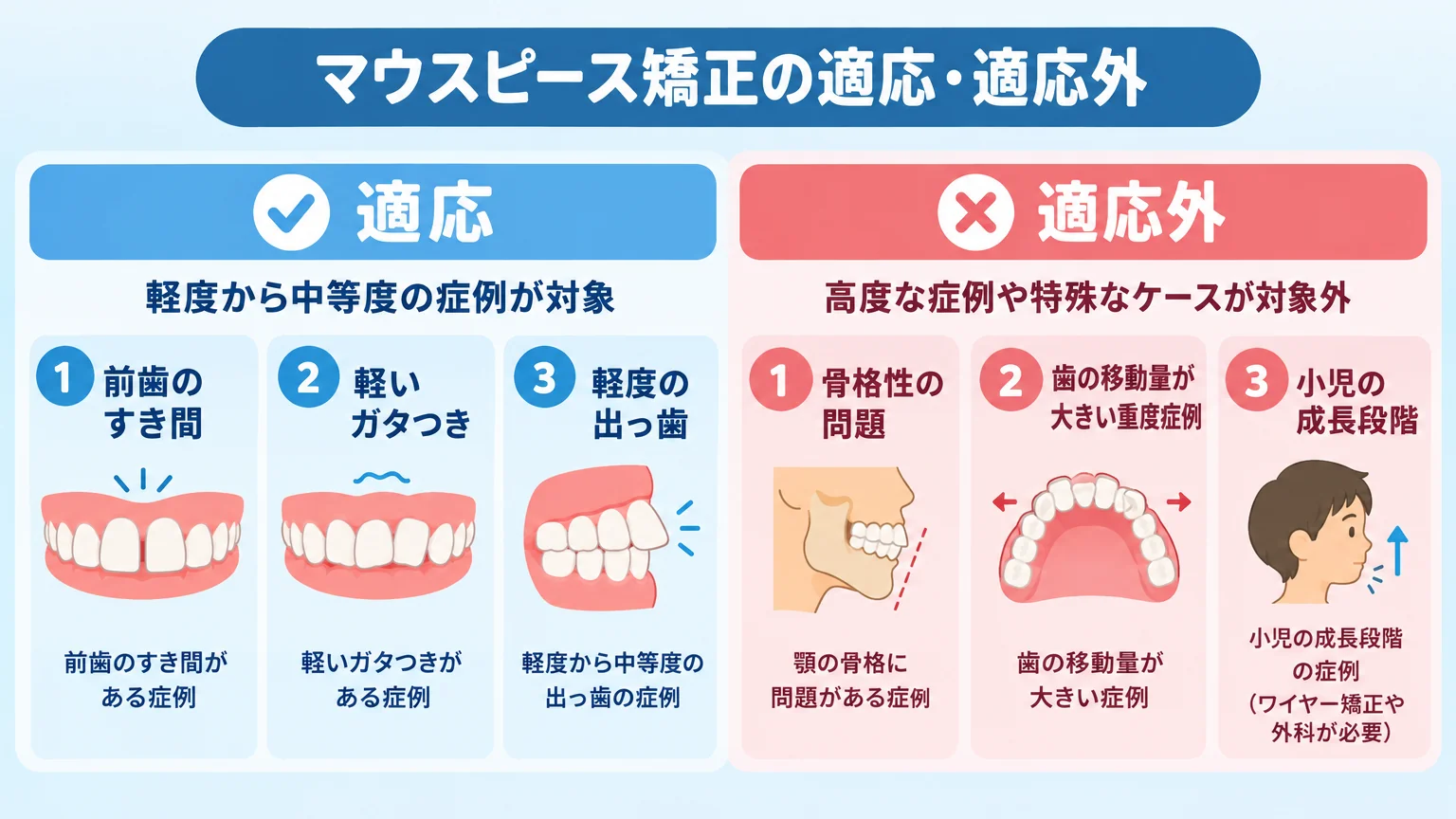 マウスピース矯正の適応・適応外を図解するイラスト。適応=前歯のすき間・軽いガタつき・軽度の出っ歯(軽度〜中等度の症例)、適応外=骨格性の問題・歯の移動量が大きい重度症例・小児の成長段階(ワイヤー矯正や外科が必要)の2分類フロー