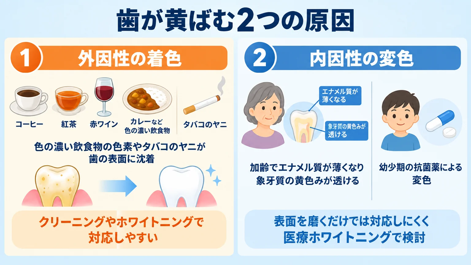 歯が黄ばむ2つの原因の図解。①外因性の着色=コーヒー・紅茶・赤ワイン・カレーなど色の濃い飲食物の色素、タバコのヤニが歯の表面に沈着→クリーニングやホワイトニングで対応しやすい。②内因性の変色=加齢でエナメル質が薄くなり象牙質の黄色みが透ける、幼少期の抗菌薬による変色→表面を磨くだけでは対応しにくく医療ホワイトニングで検討