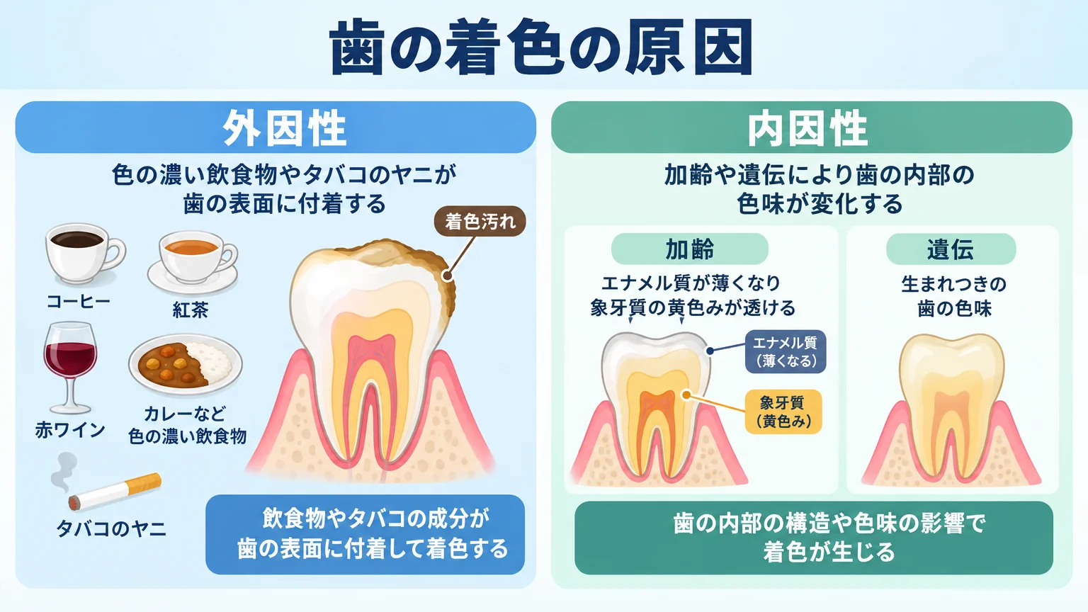 歯の着色の原因を外因性と内因性の2つに分けて図解するイラスト。外因性(コーヒー・紅茶・赤ワイン・カレーなど色の濃い飲食物、タバコのヤニが歯の表面に付着)と内因性(加齢でエナメル質が薄くなり象牙質の黄色みが透ける、遺伝による生まれつきの歯の色味)を左右に並べ、歯の断面図で着色のメカニズムを示す