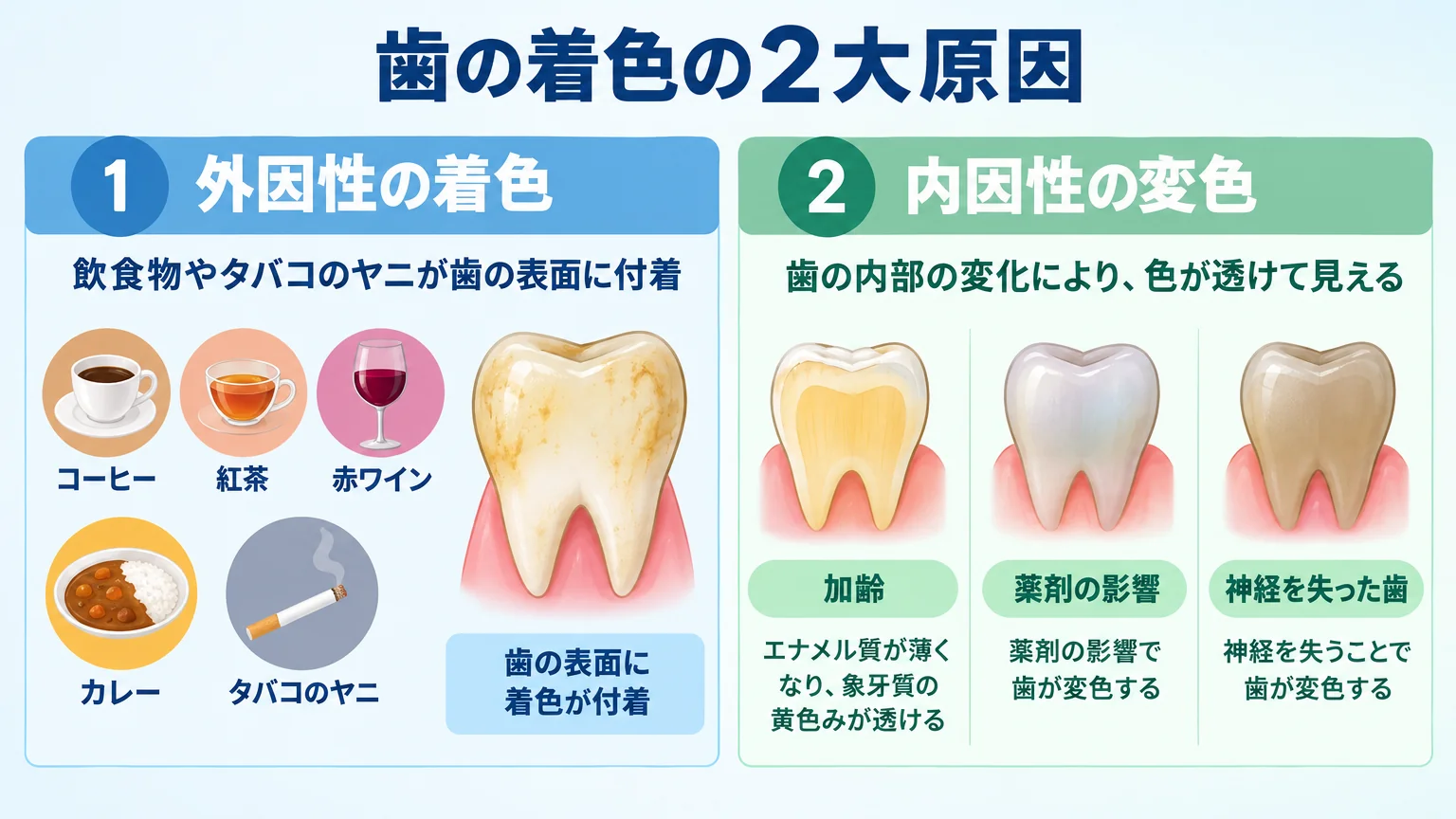 歯の着色の2大原因を示すイラスト。左側に外因性の着色(コーヒー・紅茶・赤ワイン・カレー・タバコのヤニが歯の表面に付着)、右側に内因性の変色(加齢でエナメル質が薄くなり象牙質の黄色みが透ける、薬剤の影響、神経を失った歯の変色)を対比したillustration