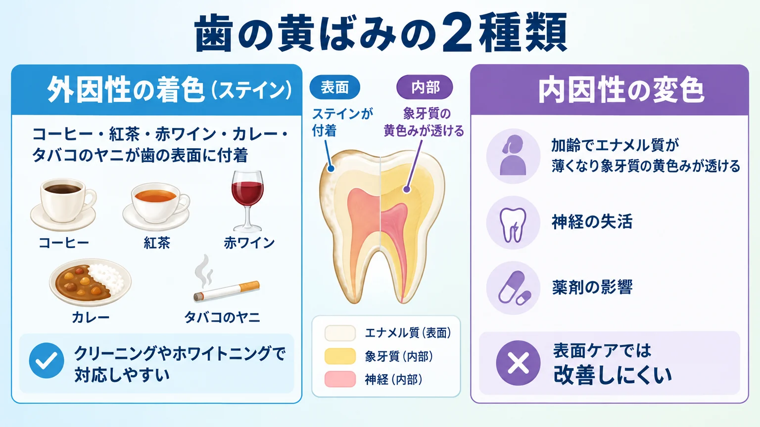 歯の黄ばみの2種類を比較するイラスト。外因性の着色（ステイン）=コーヒー・紅茶・赤ワイン・カレー・タバコのヤニが歯の表面に付着、クリーニングやホワイトニングで対応しやすい。内因性の変色=加齢でエナメル質が薄くなり象牙質の黄色みが透ける・神経の失活・薬剤の影響、表面ケアでは改善しにくい。歯の断面図で表面と内部を色分けして示す