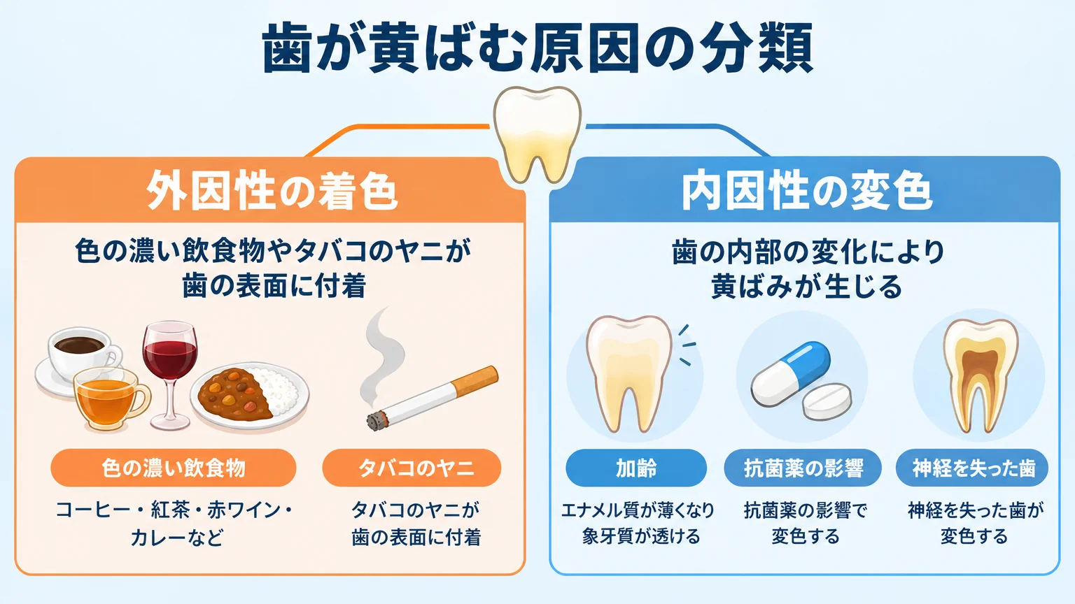 歯が黄ばむ原因の分類図。外因性の着色(コーヒー・紅茶・赤ワイン・カレーなど色の濃い飲食物、タバコのヤニが歯の表面に付着)と、内因性の変色(加齢でエナメル質が薄くなり象牙質が透ける、抗菌薬の影響、神経を失った歯の変色)を2つの枝分かれイラストで対比表示