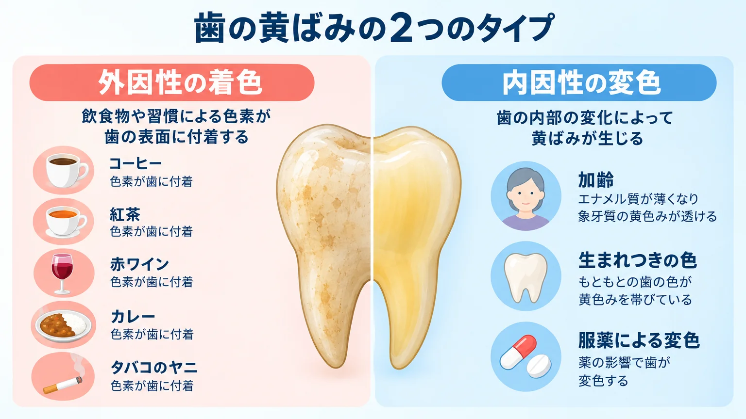歯の黄ばみの2タイプを対比したイラスト。左側に外因性の着色（コーヒー・紅茶・赤ワイン・カレー・タバコのヤニが歯の表面に付着）、右側に内因性の変色（加齢でエナメル質が薄くなり象牙質の黄色みが透ける、生まれつきの色、服薬による変色）を図解