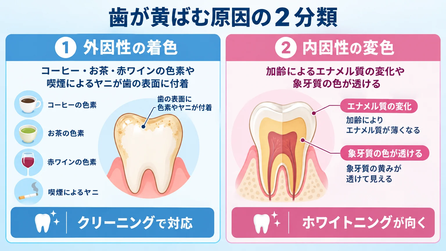 歯が黄ばむ原因の2分類を示すイラスト図解。左側に外因性の着色(コーヒー・お茶・赤ワインの色素や喫煙によるヤニが歯の表面に付着)、右側に内因性の変色(加齢によるエナメル質の変化や象牙質の色が透ける)を歯の断面図とともに対比表示。外因性はクリーニングで対応、内因性はホワイトニングが向く旨を添える