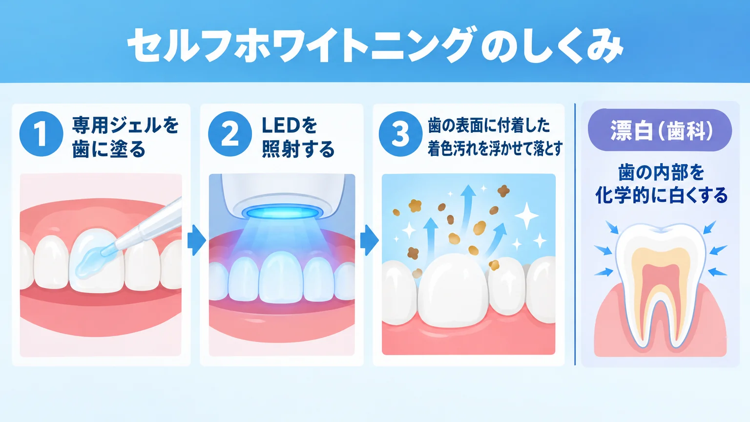 セルフホワイトニングの仕組みを説明するイラスト。ステップ1=専用ジェルを歯に塗る、ステップ2=LEDを照射する、ステップ3=歯の表面に付着した着色汚れを浮かせて落とす。右側に対比として「漂白(歯科)=歯の内部を化学的に白くする」を併記。タイトルは「セルフホワイトニングのしくみ」