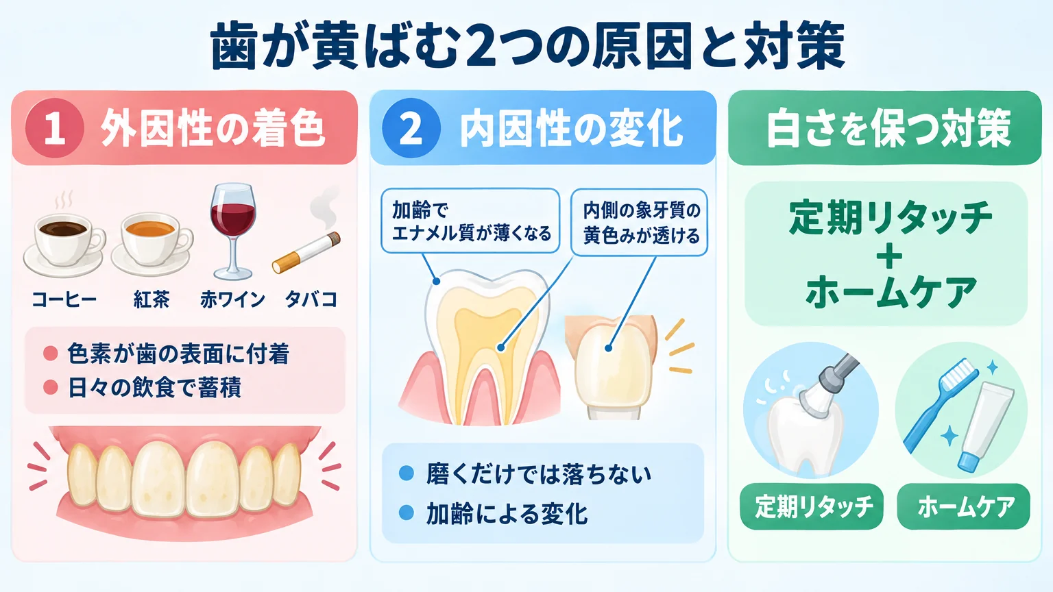 歯が黄ばむ2つの原因の図解。外因性の着色:コーヒー・紅茶・赤ワイン・タバコの色素が歯の表面に付着・日々の飲食で蓄積。内因性の変化:加齢でエナメル質が薄くなり内側の象牙質の黄色みが透ける・磨くだけでは落ちない。白さを保つ対策=定期リタッチ+ホームケア
