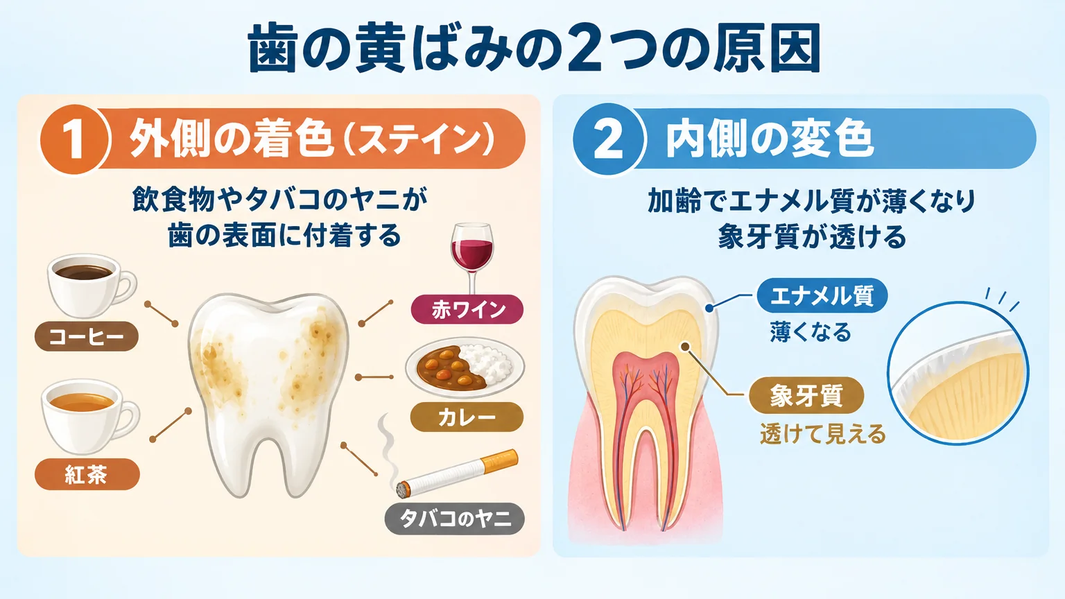 歯の黄ばみの2つの原因を対比したイラスト。左側に「外側の着色(ステイン)」としてコーヒー・紅茶・赤ワイン・カレー・タバコのヤニが歯の表面に付着する図、右側に「内側の変色」として加齢でエナメル質が薄くなり象牙質が透ける断面図を配置