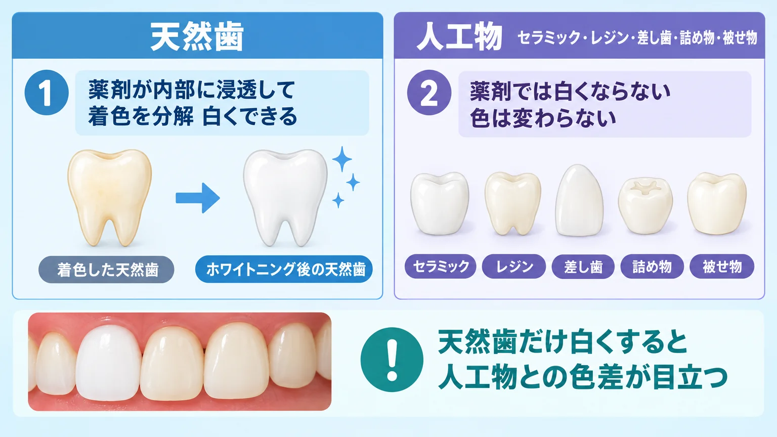 天然歯と人工物のホワイトニング可否の比較図。天然歯(薬剤が内部に浸透して着色を分解、白くできる)と人工物=セラミック・レジン・差し歯・詰め物・被せ物(薬剤では白くならない、色は変わらない)を左右に並べ、天然歯だけ白くすると人工物との色差が目立つ点を示したイラスト