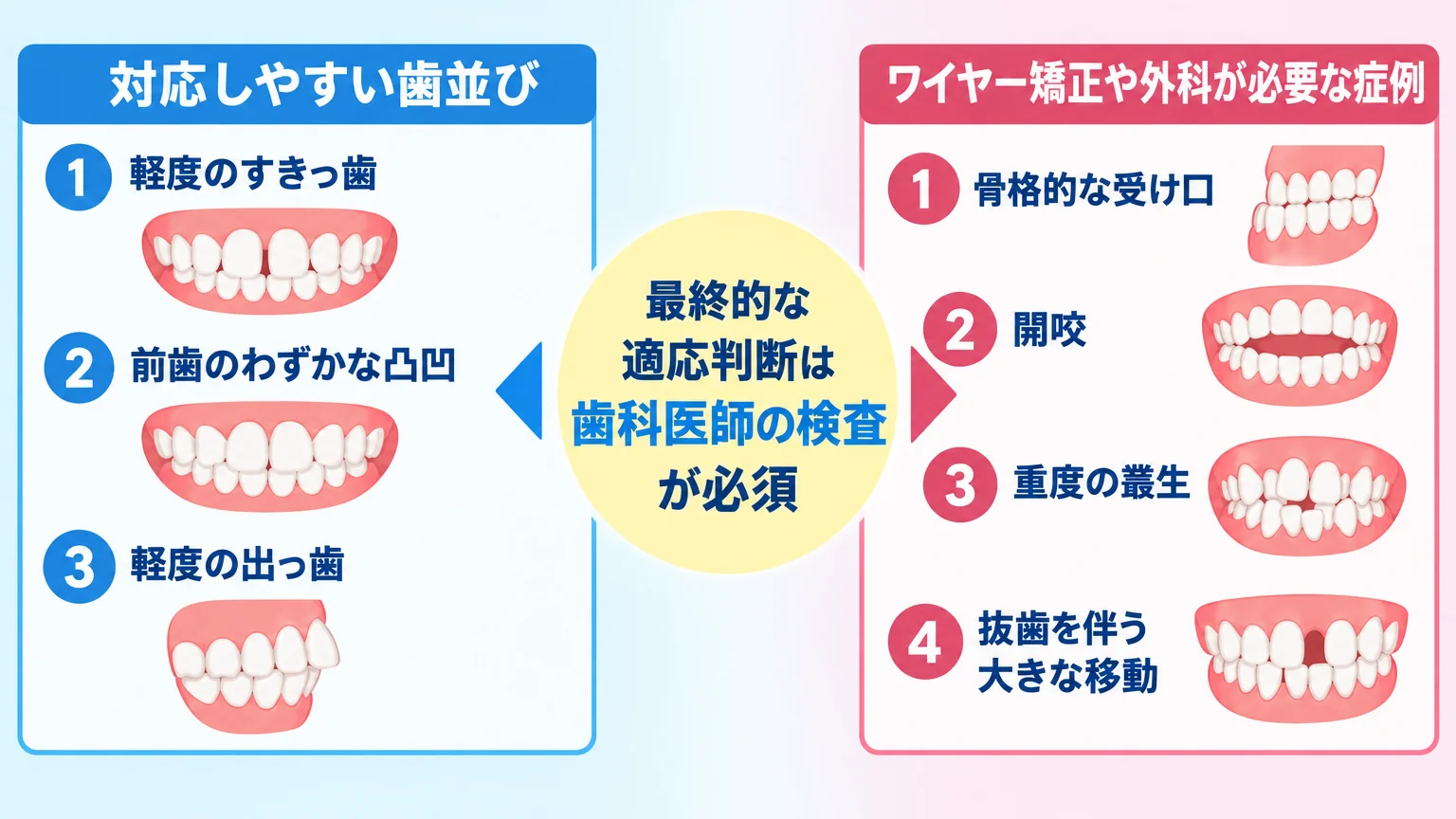 マウスピース矯正の適応・適応外を示すイラスト図。左側「対応しやすい歯並び」=軽度のすきっ歯・前歯のわずかな凸凹・軽度の出っ歯。右側「ワイヤー矯正や外科が必要な症例」=骨格的な受け口・開咬・重度の叢生・抜歯を伴う大きな移動。中央に『最終的な適応判断は歯科医師の検査が必須』と明記