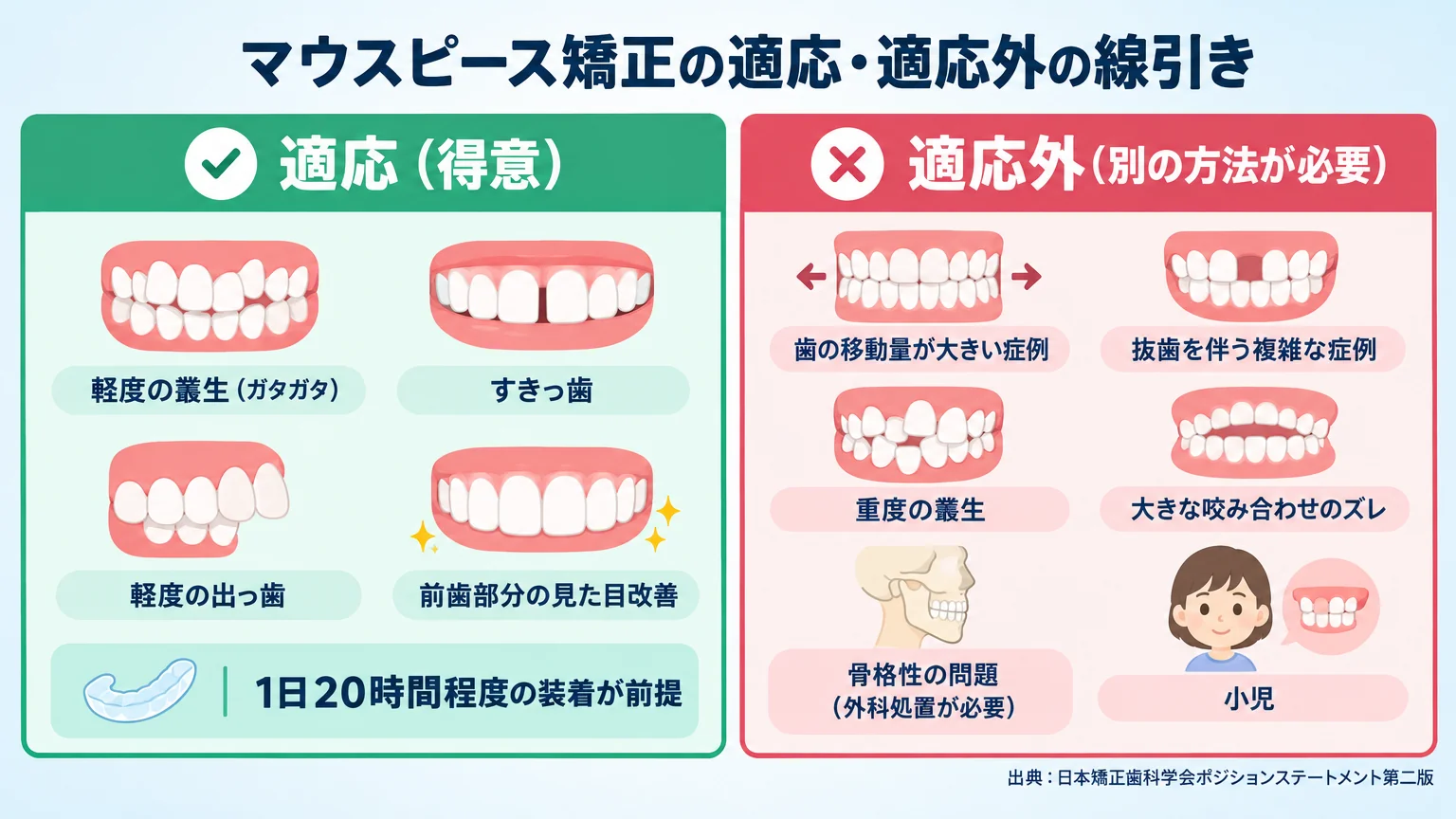 マウスピース矯正の適応・適応外の線引き図。【適応(得意)】軽度の叢生(ガタガタ)、すきっ歯、軽度の出っ歯、前歯部分の見た目改善。1日20時間程度の装着が前提。【適応外(別の方法が必要)】歯の移動量が大きい症例、抜歯を伴う複雑な症例、重度の叢生、大きな咬み合わせのズレ、骨格性の問題(外科処置が必要)、小児。出典:日本矯正歯科学会ポジションステートメント第二版