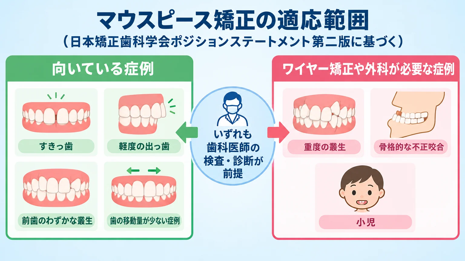 マウスピース矯正の適応・適応外を分けるフロー図のイラスト。左側に『向いている症例』としてすきっ歯・軽度の出っ歯・前歯のわずかな叢生・歯の移動量が少ない症例を配置。右側に『ワイヤー矯正や外科が必要な症例』として重度の叢生・骨格的な不正咬合・小児を配置。中央に『いずれも歯科医師の検査・診断が前提』と明記。タイトルは『マウスピース矯正の適応範囲(日本矯正歯科学会ポジションステートメント第二版に基づく)』
