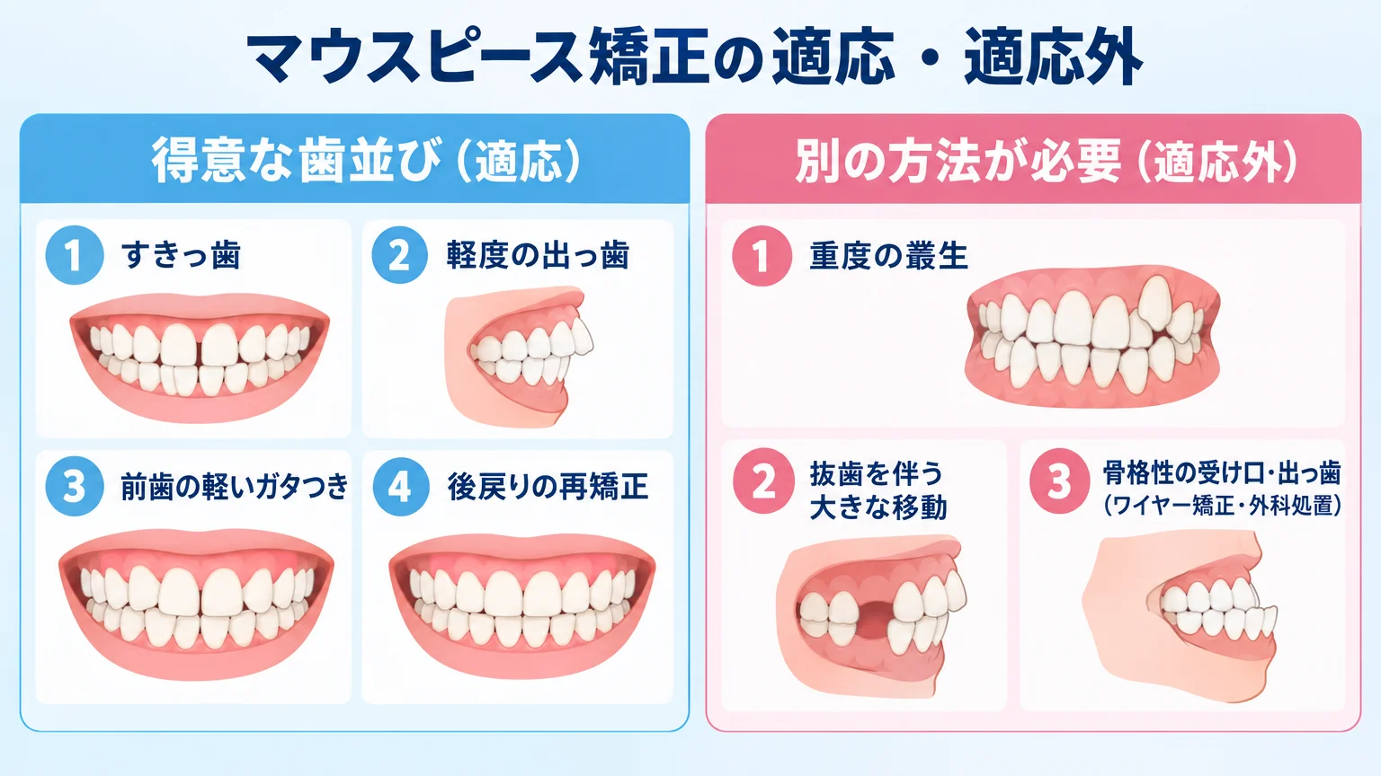 マウスピース矯正の適応・適応外を二分するイラスト。左側『得意な歯並び(適応)=すきっ歯/軽度の出っ歯/前歯の軽いガタつき/後戻りの再矯正』、右側『別の方法が必要(適応外)=重度の叢生/抜歯を伴う大きな移動/骨格性の受け口・出っ歯(ワイヤー矯正・外科処置)』を歯並びイラスト付きで対比する